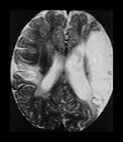 Fig. 7.22 (c) Fig. 7.22 (c)