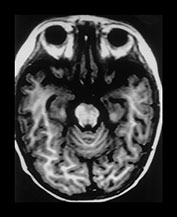 Fig. 7.22 (d) Fig. 7.22 (d)