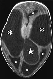 Fig. 27 (a) Fig. 11.27 (a)