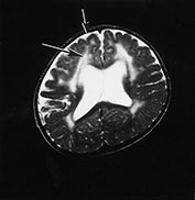 Fig. 14.2 (b) Fig. 14.2 (b)