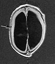 Fig. 14.3 (a) Fig. 14.3 (a)