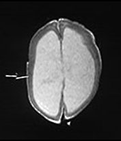 Fig. 14.3 (b) Fig. 14.3 (b)