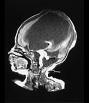 Fig. 14.3 (c) Fig. 14.3 (c)