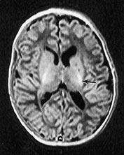 Fig. 14.7 (a) Fig. 14.7 (a)