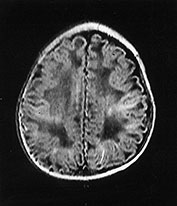 Fig. 14.7 (c) Fig. 14.7 (c)