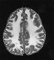 Fig. 14.7 (d) Fig. 14.7 (d)