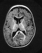 Fig. 14.7 (e) Fig. 14.7 (e)