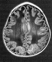 Fig. 14.7 (f) Fig. 14.7 (f)