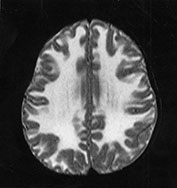 Fig. 14.7 (g) Fig. 14.7 (g)