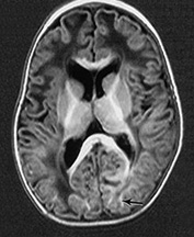 Fig. 14.7 (h) Fig. 14.7 (h)