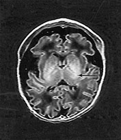 Fig. 14.8 (a) Fig. 14.8 (a)