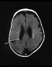 Fig. 14.9 (a) Fig. 14.9 (a)
