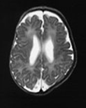 Fig. 14.9 (c) Fig. 14.9 (c)