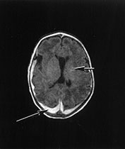 Fig. 14.10 (a) Fig. 14.10 (a)