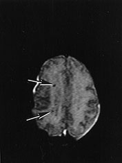 Fig. 14.10 (c) Fig. 14.10 (c)