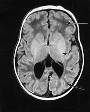 Fig. 14.13 (a) Fig. 14.13 (a)