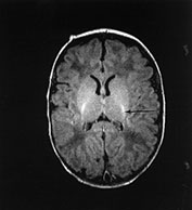 Fig. 14.14 (a) Fig. 14.14 (a)