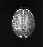 Fig. 14.14 (c) Fig. 14.14 (c)
