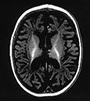 Fig. 14.14 (d) Fig. 14.14 (d)