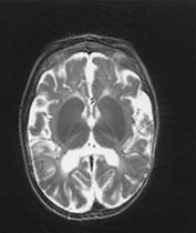 Fig. 14.14 (e) Fig. 14.14 (e)