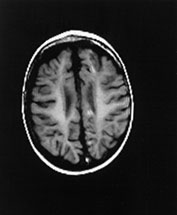 Fig. 14.14 (f) Fig. 14.14 (f)