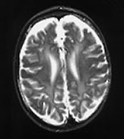 Fig. 14.14 (g) Fig. 14.14 (g)