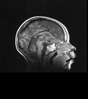 Fig. 14.14 (h) Fig. 14.14 (h)
