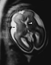 Fig. 15.1 (b) Fig. 15.1 (b)