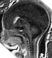 Fig. 15.4 (c) Fig. 15.4 (c)