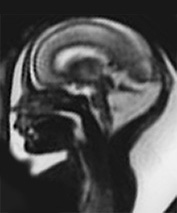 Fig. 15.7 (a) Fig. 15.7 (a)