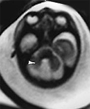 Fig. 15.7 (b) Fig. 15.7 (b)