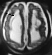 Fig. 15.8 (a) Fig. 15.8 (a)