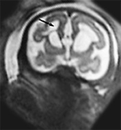 Fig. 15.8 (b) Fig. 15.8 (b)