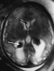 Fig. 15.9 (b) Fig. 15.9 (b)