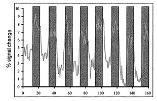 Fig. 18.1 (b)