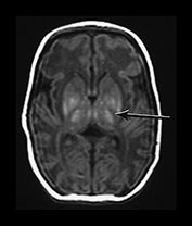 Fig. 6.3 (di) Fig. 6.3 (di)