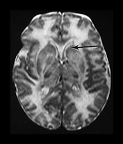 Fig. 6.6 (dii) Fig. 6.6 (dii)