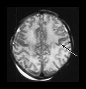 Fig. 6.10 (a) Fig. 6.10 (a)