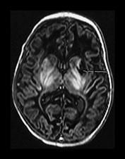 Fig. 6.19 (ai) Fig. 6.19 (ai)