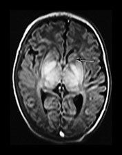 Fig. 6.20 (a) Fig. 6.20 (a)