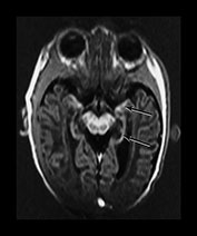 Fig. 6.20 (bii) Fig. 6.20 (bii)