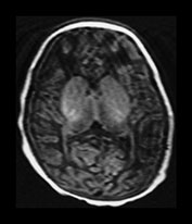 Fig. 6.21 (a) Fig. 6.22 (a)