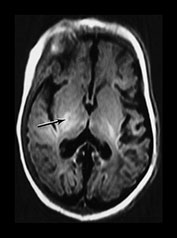 Fig. 6.21 (bi) Fig. 6.22 (bi)