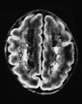 Fig. 8.3 (a)