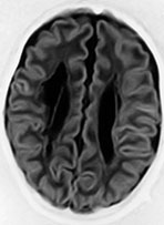 Fig. 8.3 (b)