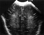 Fig. 8.6 (a)