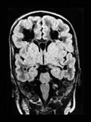 Fig. 8.7 (c)