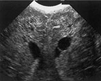 Fig. 8.8 (a)