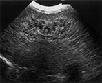 Fig. 8.8 (b)