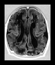 Fig. 8.8 (c)